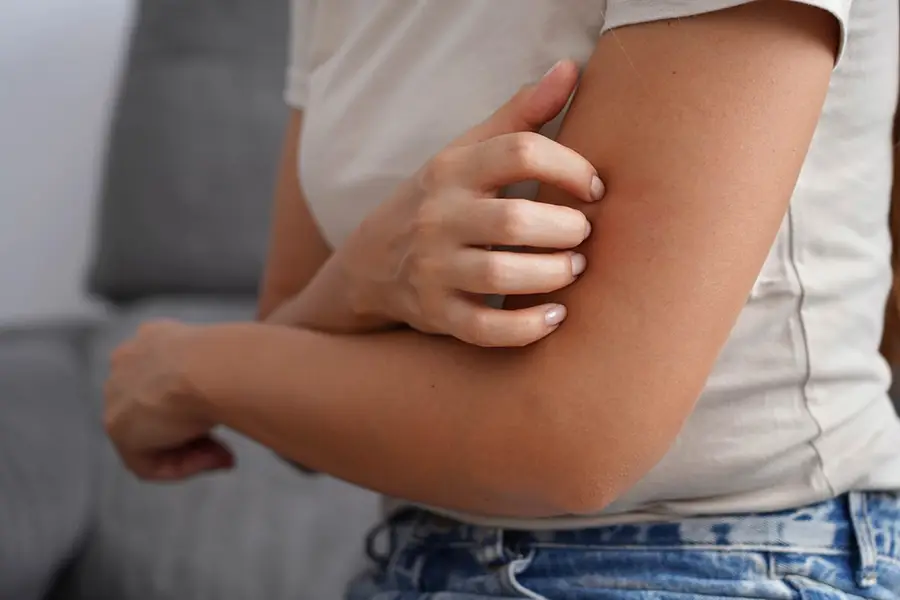 contact dermatitis at work
